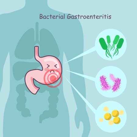 natural remedies for gastroenteritis IBD IBS irritable bowel SIBO digestion